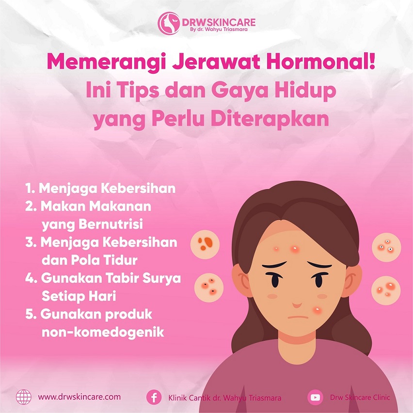 Memerangi Jerawat Hormonal! Ini Tips dan Gaya Hidup yang Perlu Diterapkan